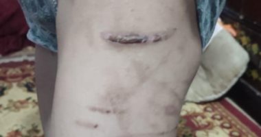 بلاغ يتهم زوجة أب بتعذيب نجل زوجها واحتجازه بالفيوم