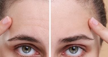 وصفات طبيعية للتخلص من تجاعيد الجبهة.. تخلصى من علامات العبوس 