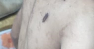 النيابة تباشر التحقيق مع زوجة الأب المتهمة بتعذيب نجل زوجها