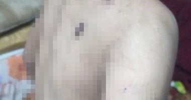 زوجة أب تحول منزلها إلى جحيم لطفل زوجها فى الفيوم