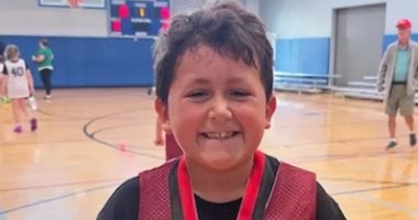 طفل أمريكى يصاب بحروق فى وجهه بسبب تريند " NeeDoh " على التيك توك