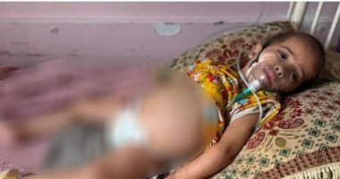 لحقت بشقيقها الأصغر.. وفاة الطفلة الفلسطينية لانا زعرب بسبب مرض نادر داخل غزة.. الاحتلال لم يرحم صرخاتها اليومية ورفض علاجها بالخارج.. والأم قبل فقدان ابنتها: دعيت الله يصبر قلبي ويقويني على فراقها