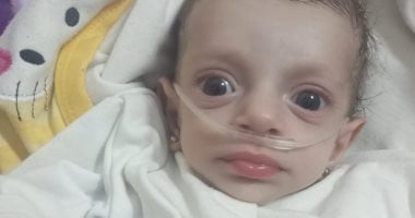 الطفلة ألما والحياة آلام.. حكاية رضيعة فلسطينية تعانى على أجهزة الأكسجين فى غزة.. ألما أبو ريدة تصارع المرض وتقاتل نقص الإمكانيات الطبية.. والدتها: نكافح من أجل فرصة حياة لابنتى حتى لا تتكرر مأساة فقدان شقيقتها