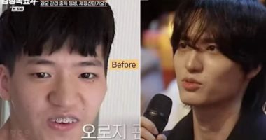 كورى ينفى خضوعه لجراحة تجميل رغم تحول مظهره المذهل.. صور