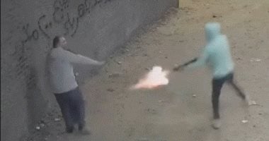 حقيقة بتـر قدم طفل باسوس المصاب بطلق خرطوش فى القليوبية.. فيديو