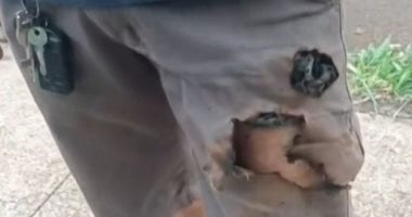 لعبة القدر.. نجاة رجل برازيلى من هجوم كلبين بعد انفجار الهاتف فى جيبه