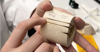 استخدام الليزر بجراحة العظام يحقق نتائج أفضل.. دراسة توضح