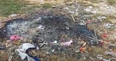 قرارات النيابة بشأن الأم المتهمة بإشعال النار فى ابنتها بالشرقية.. فيديو