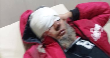 كسر في الجمجمة.. كلاب ضالة تتسبب في إصابة مُسن في بورسعيد