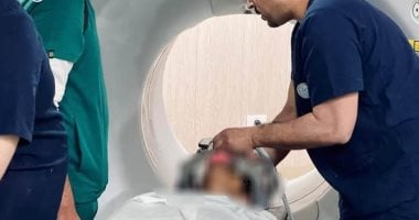 نجاح أول عملية زرع مضخة باكلوفين لعلاج تشنج عضلي شديد لمريض بمستشفى الكرنك