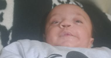 الرضيع علاء أبو طه بين أنف بفتحة واحدة وعينين فاقدتين للبصر..مأساة صحية لطفل فلسطيني تهدد حياته كل يوم بعد انهيار المستشفيات ونقص العلاج.. والده: كل يوم يمضي يهدد بصره ونحتاج علاجا عاجلا خارج غزة 