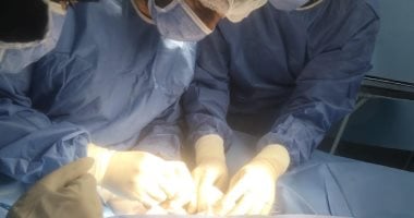 نجاح أول عملية جراحة لتركيب صمام خارجي لعلاج استسقاء المخ بمستشفى دكرنس العام