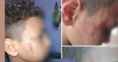 سبّها أمام زملائه فضربته.. كواليس إصابة طالب بخناقة مع معلمته بسوهاج