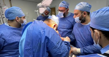 فريق طبى بمستشفى سيدى غازى يجرى عمليتى استئصال طحال مريض بالمنظار