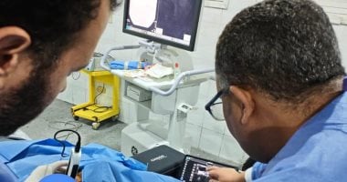 تثبيت 4 كسور لمسن فى عملية واحدة بمستشفى قنا العام