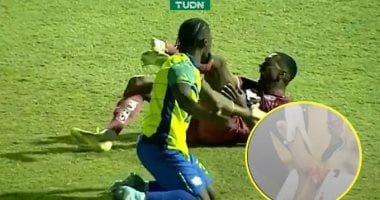 إصابة مأساوية للبرازيلي روماريو دا سيلفا في الدوري الهندوراسي.. فيديو 