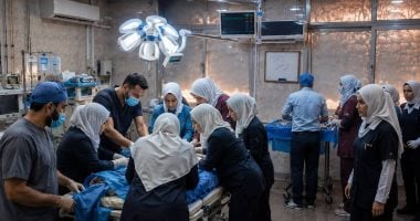"سيخ حديدي" يخترق جسد فتاة وأطباء المنوفية ينجحون فى إنقاذها