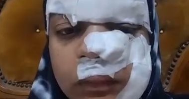 زوج يمزق وجه ويد زوجته بسبب دعوى خلع بالغربية