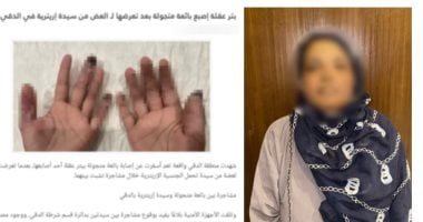 ضبط بائعة أجنبية قطعت صابع زميلة بسبب خلاف على الأطفال