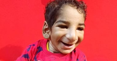 الطفل أنس علاء