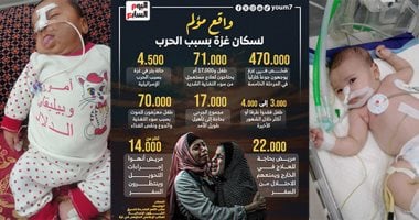 خارج حسابات الإغاثة.. الموت الصامت فى غرف المعاناة.. من بيكويث ويدمان إلى ستيفن جونسون الأمراض النادرة والمتلازمات تتحول إلى حكم بالموت البطىء على أطفال غزة.. وغياب العلاج وعجز المستشفيات يزيدان المعاناة
