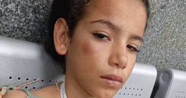 لخلافات أسرية طفلة تلقى بنفسها من الطابق الرابع فى الشرقية