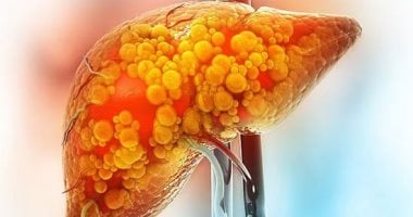 نظام الكيتو دايت يمنع الإصابة بالسكر ويعالج الكبد الدهنى.. دراسة تكشف