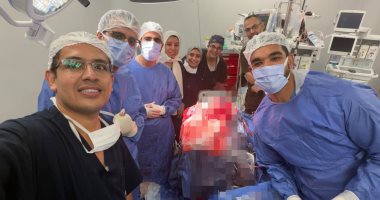 مسمار يخترق جمجمة مريض ويستقر قرب شرايين المخ.. أطباء قصر العيني ينقذون حياته