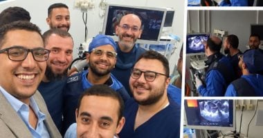 إجراء 13 عملية باستخدام منظار الموجات الصوتية المتقدمة بكفر الشيخ