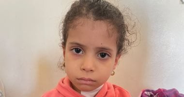 جراحة قلب مفتوح لطفلة عمرها 5 سنوات بفتحة 5 سم فى مستشفيات جامعة الزقازيق