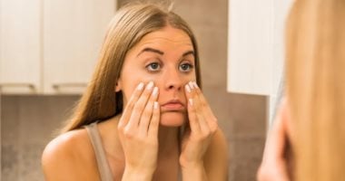 أعراض نقص الحديد على الوجه