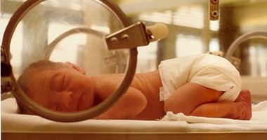 مشاكل الخصوبة تزيد من مخاطر ولادة طفل مبتسر أو يعانى تشوهات خلقية