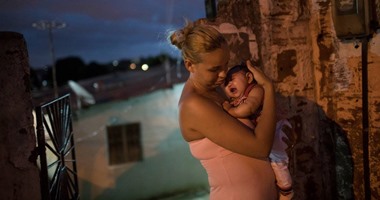 إصابة 11 امرأة حامل فى المكسيك بفيروس زيكا