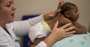 دراسة أمريكية: فيروس زيكا يسبب نوبات صرع عند الرضع