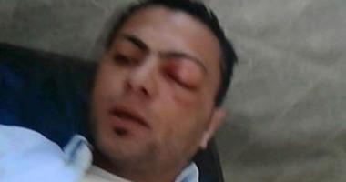 شاب مصاب بحادث يحرر محضر ضد طبيب بالفرافرة رفض اسعافه