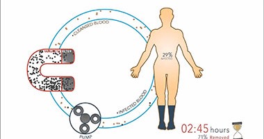 بالفيديو.. أحدث جهاز لعلاج الملاريا باستخدام "فلتر مغناطيسى" ينقى الدم
