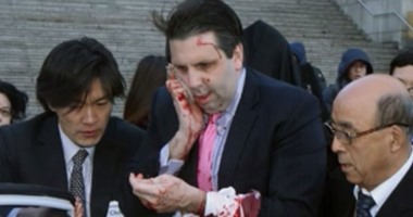 الفرنسية: إصابة السفير الأمريكى بكوريا الجنوبية بجروح خطيرة فى هجوم مسلح