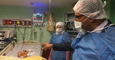 إجراء أول 7 عمليات قلب مفتوح للأطفال بمستشفى جامعة مصر للعلوم