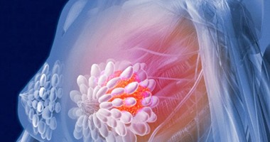 بعض أدوية العلاج المناعى للسرطان قد تزيد خطر الإصابة بالتهاب المفاصل