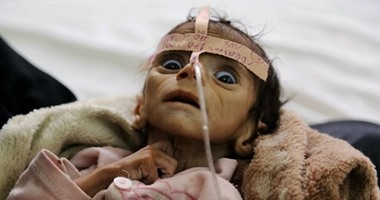 6 منظمات غير حكومية تحذر من وضع انسانى كارثى فى اليمن