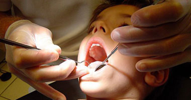 أسباب جز الطفل على أسنانه وطرق علاجها