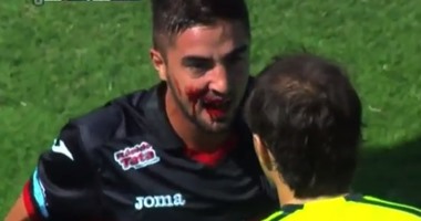 بالفيديو.. الدماء تسيل من فم لاعب بعد تدخل قوى بالدورى الأرجنتينى