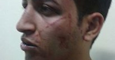 نيابة شرق القاهرة تباشر التحقيق مع الضابط المتهم بإصابة سائق فى النزهة