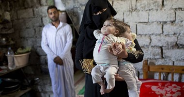 بالصور.. صحيفة إسرائيلية تبرز تقريرا عن أسرة مصرية تعانى التصاق رأس طفلتين