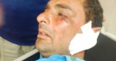 أمن بورسعيد ينهى إجراءات التصالح فى واقعة قضم أمين شرطة أذن عامل بالكهرباء