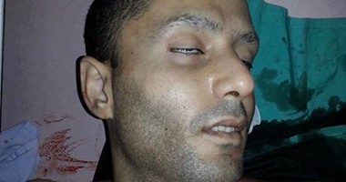 مصادر لـ"اليوم السابع": استشهاد شاب برصاص الاحتلال الإسرائيلى بنابلس