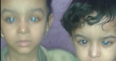 "واتس آب اليوم السابع": طفلان يحتاجان لعملية لإعادة بصرهما بسوهاج