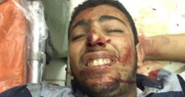 إصابة شخص مجهول الهوية فى حادث بكفر الشيخ