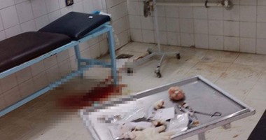 صحافة المواطن: دماء ملطخة ومخلفات طبية تزين استقبال مستشفى ميت غمر بالدقهلية