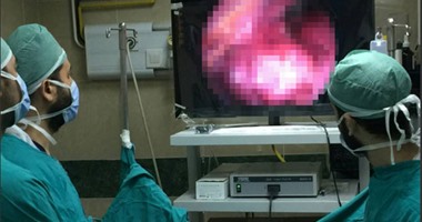 نجاح أول جراحتين للصدر بالمنظار الجراحى لأول مرة فى تاريخ جامعة المنصورة